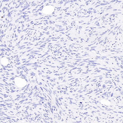 Claudin 1 Recombinant Rabbit mAb (SDT-1289-55)