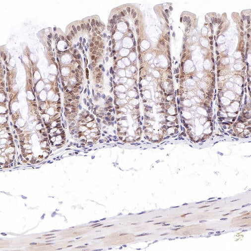 PSME1 Recombinant Rabbit mAb (S-732-14)