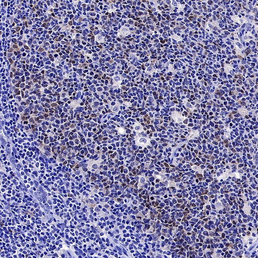 Survivin Recombinant Rabbit mAb (S-2334-26)