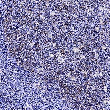Survivin Recombinant Rabbit mAb (S-2334-26)