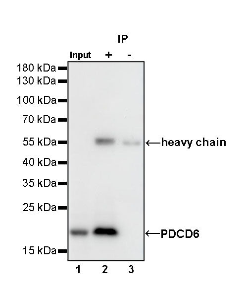 PDCD6 Recombinant Rabbit mAb (S-578-98)
