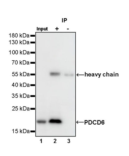 PDCD6 Recombinant Rabbit mAb (S-578-98)