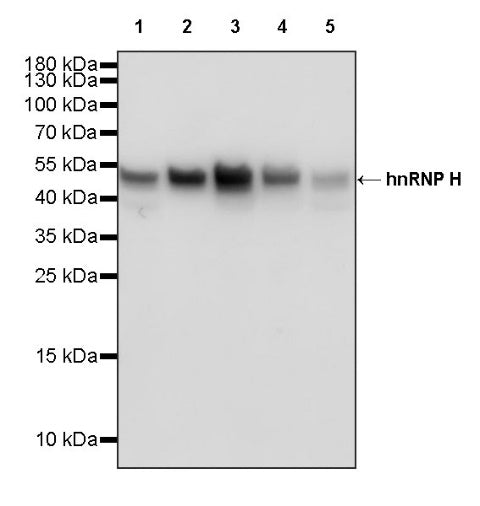 hnRNP H Rabbit Polyclonal Antibody