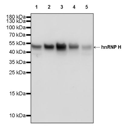 hnRNP H Rabbit Polyclonal Antibody