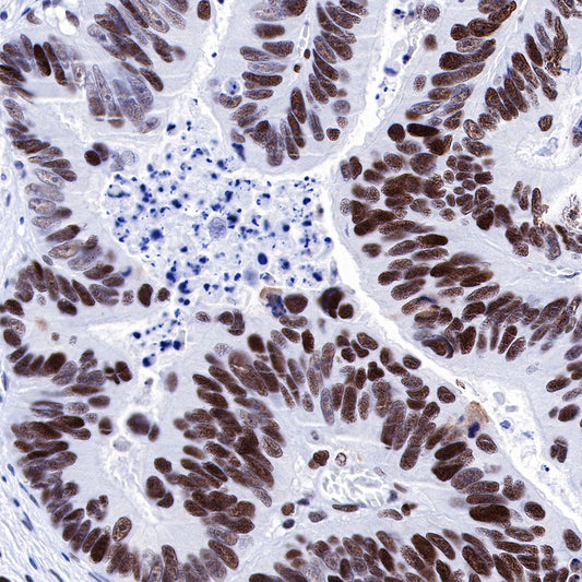 S-RMab® MSH6 Recombinant Rabbit mAb (SDT-R094)