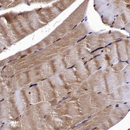 SEK1/MKK4 Rabbit Polyclonal Antibody