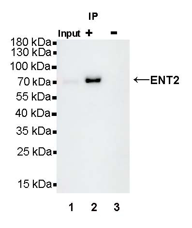 ENT2 Rabbit Polyclonal Antibody