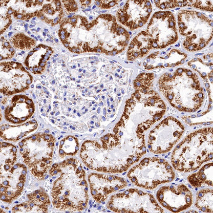 SDHB Recombinant Rabbit mAb (SDT-1162-2)