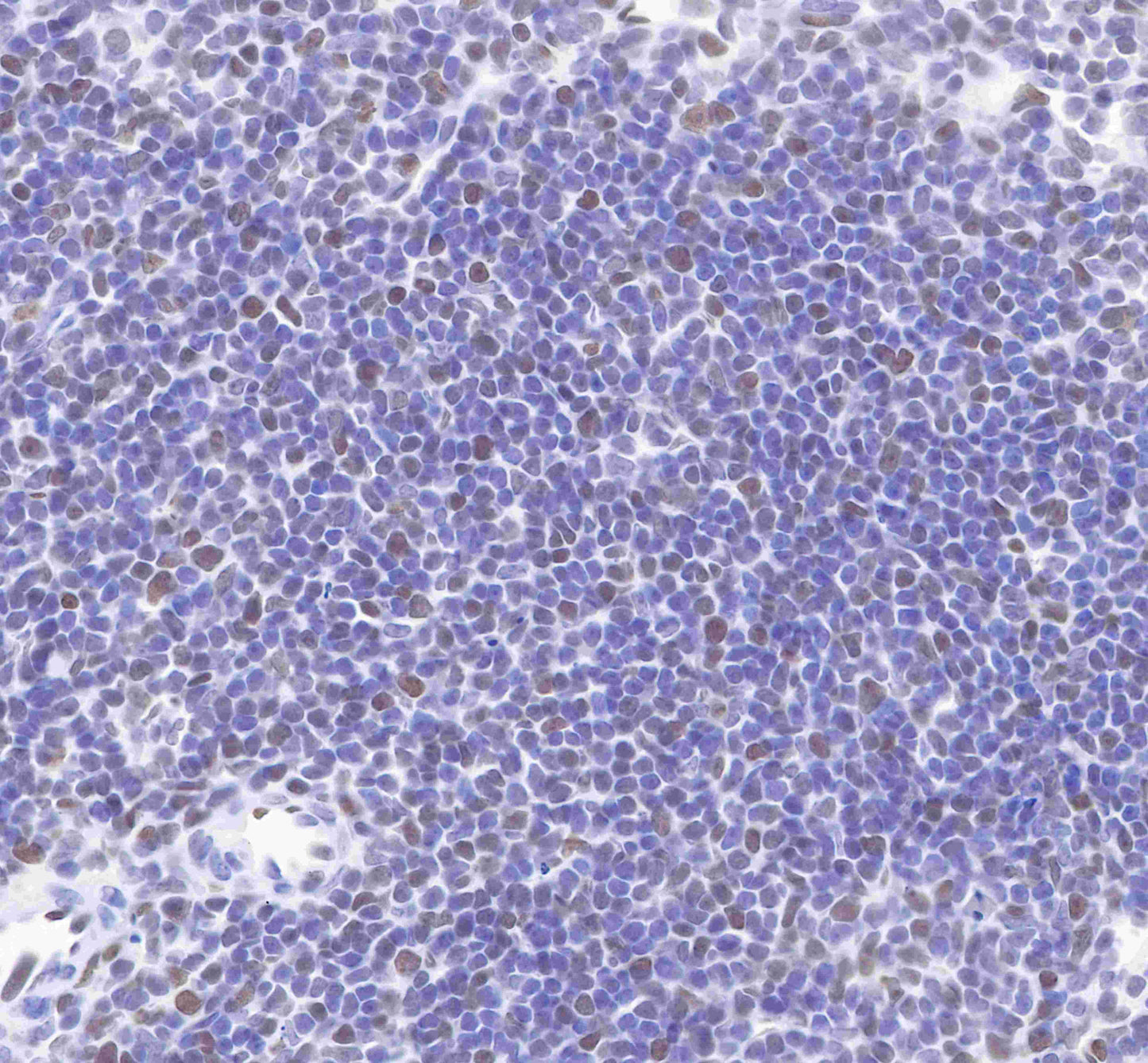 MCM2 Recombinant Rabbit mAb (SDT-018-68-2)