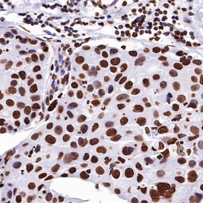 Histone H3 Recombinant Rabbit mAb (SDT-266-44)