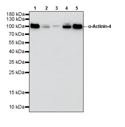 α-Actinin-4 Recombinant Rabbit mAb
