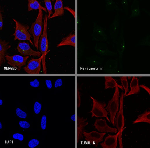 Pericentrin Recombinant Rabbit mAb (S-3493)