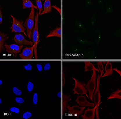 Pericentrin Recombinant Rabbit mAb (S-3493)