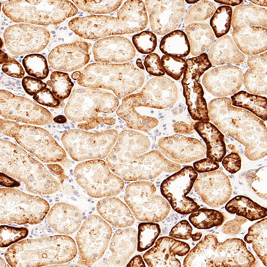 CA12 Rabbit Polyclonal Antibody