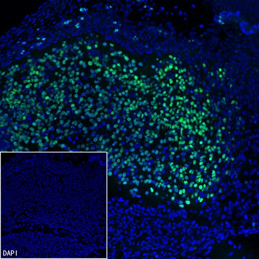 TBR2/Eomes Recombinant Rabbit mAb (SDT-1101-231)