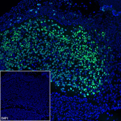 TBR2/Eomes Recombinant Rabbit mAb (SDT-1101-231)