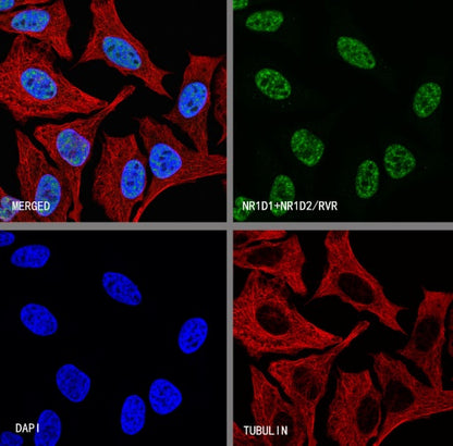 NR1D1 + NR1D2 / RVR Recombinant Rabbit mAb (S-5962)