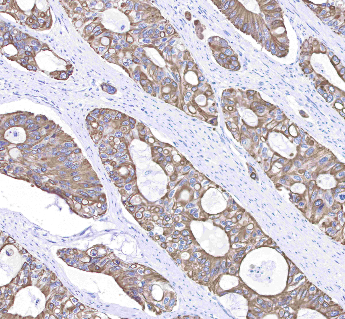Keratin 8 Recombinant Rabbit mAb (SDT-016-46)