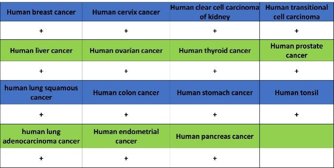 Collagen VI (COL6A1) Recombinant Rabbit mAb (S-1495-18)
