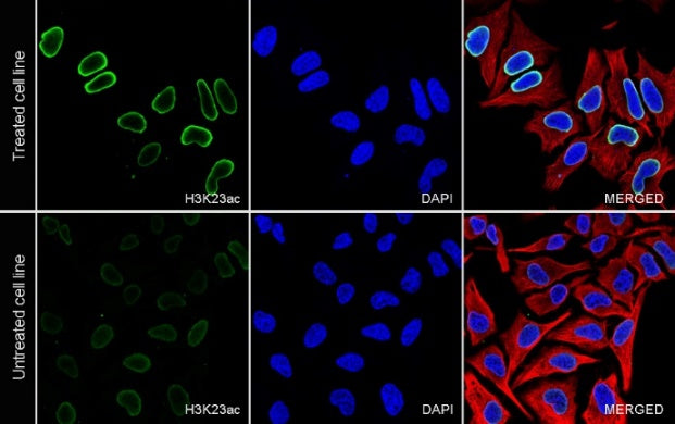Histone H3 (acetyl K23) Recombinant Rabbit mAb (S-3321-202)