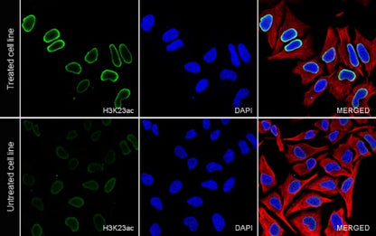 Histone H3 (acetyl K23) Recombinant Rabbit mAb (S-3321-202)