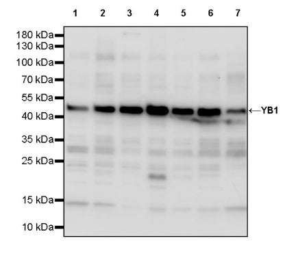 YB1 Recombinant Rabbit mAb (S-1748-144)