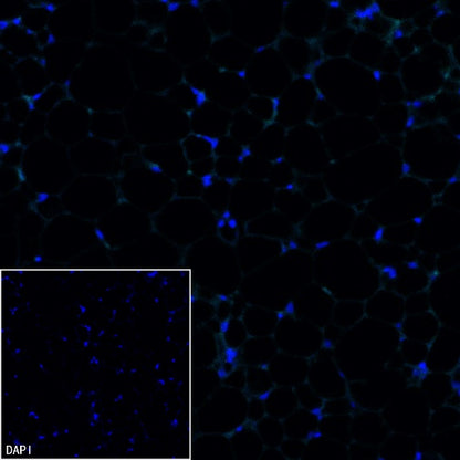UCP1 Recombinant Rabbit mAb (SDT-2275-37)
