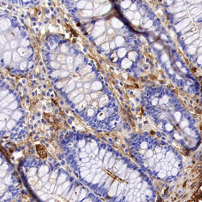 Citrate synthetase Recombinant Rabbit mAb (S-1708-56)