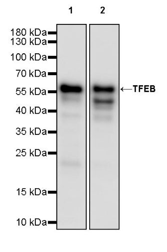 TFEB Recombinant Rabbit mAb,PBS Only (SDT-2411-7)