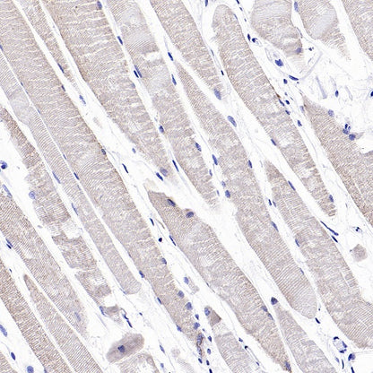PDLI7/LMP1 Recombinant Rabbit mAb (S-2150-68)