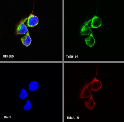 TMEM119 Recombinant Rabbit mAb (S-838-46)