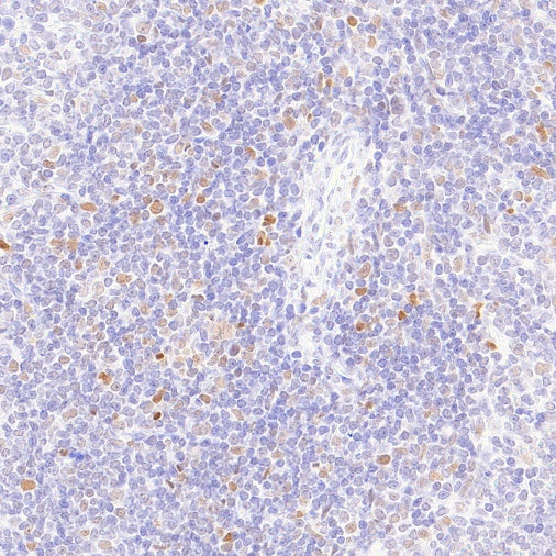 FOXP4 Recombinant Rabbit mAb (S-6198)