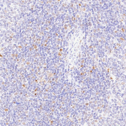 FOXP4 Recombinant Rabbit mAb (S-6198)