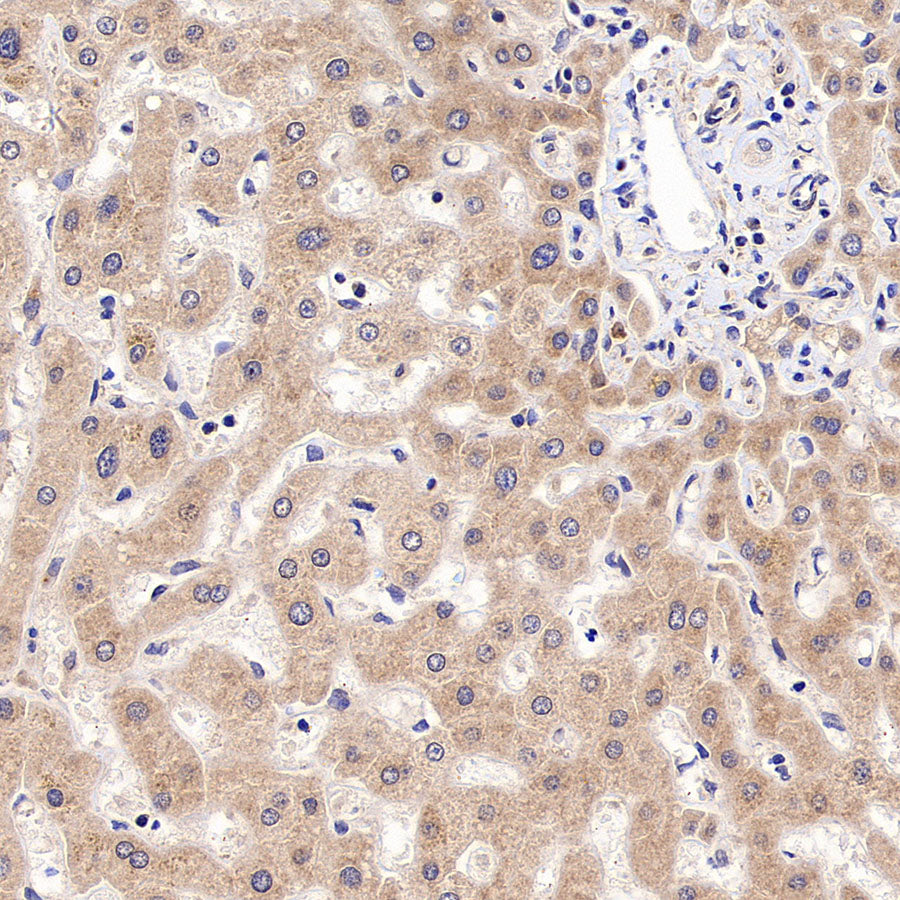 RPLP0 Rabbit Polyclonal Antibody