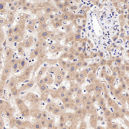 RPLP0 Rabbit Polyclonal Antibody