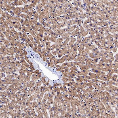 SOD2/MnSOD (acetyl K68) Rabbit Polyclonal Antibody