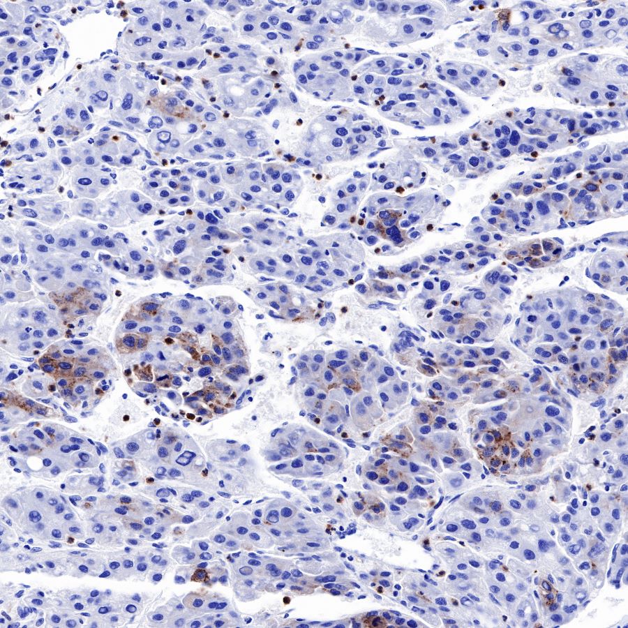 AFP Recombinant Rabbit mAb (SDT-R031)
