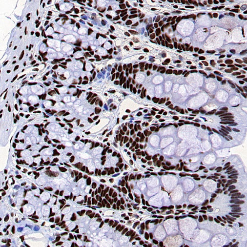 FUS Recombinant Rabbit mAb (S-1015-21)