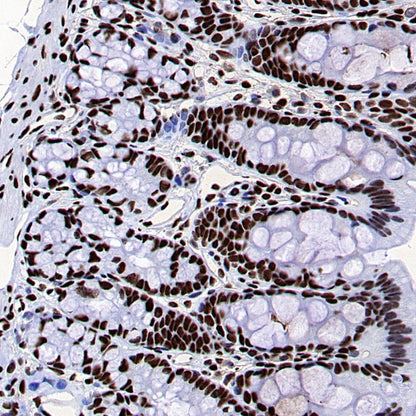 FUS Recombinant Rabbit mAb (S-1015-21)
