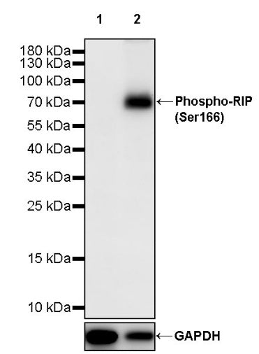 Phospho-RIP (Ser166) Recombinant Rabbit mAb (S-2702-58)