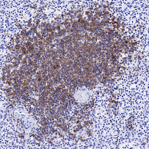 CD19 Recombinant Rabbit mAb (SDT-164-41)