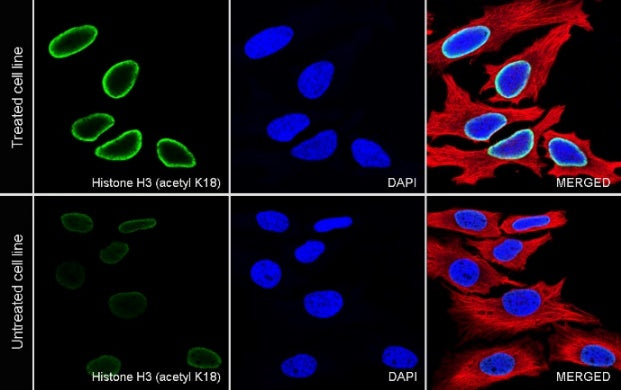 Histone H3 (acetyl K18) Recombinant Rabbit mAb (S-1688-90)