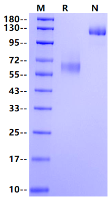 IL-7R alpha/CD127 Fc Chimera Protein, Mouse