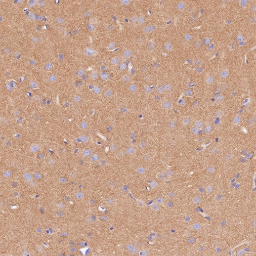 S-RMab® Pan Trk Recombinant Rabbit mAb (SDT-512-5)