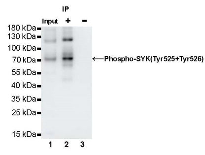 Phospho-Syk (Tyr525/526) Recombinant Rabbit mAb (S-1245-113)