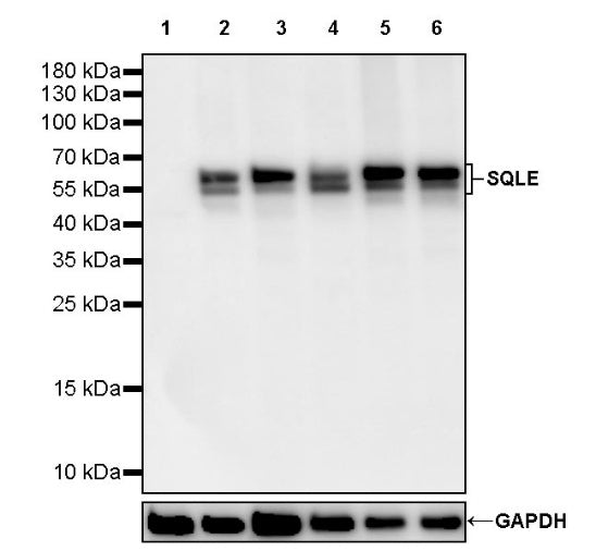 SQLE Recombinant Rabbit mAb (S-2358-207)