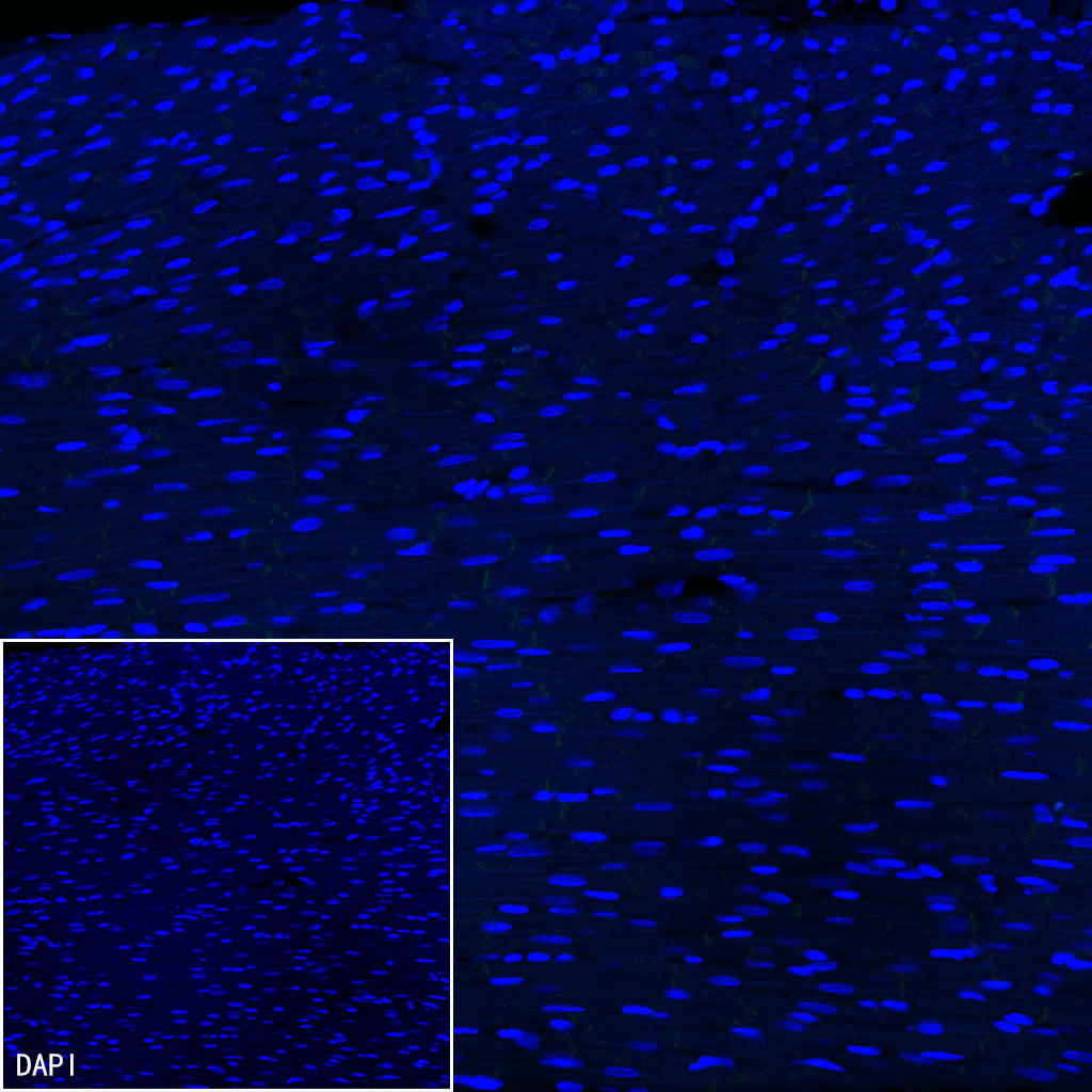 H+/K+-ATPase Recombinant Rabbit mAb (S-3474-110)