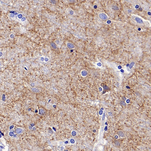 LOX Recombinant Rabbit mAb (S-1647-49)