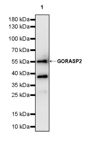 GORASP2 Recombinant Rabbit mAb (S-2526-47)