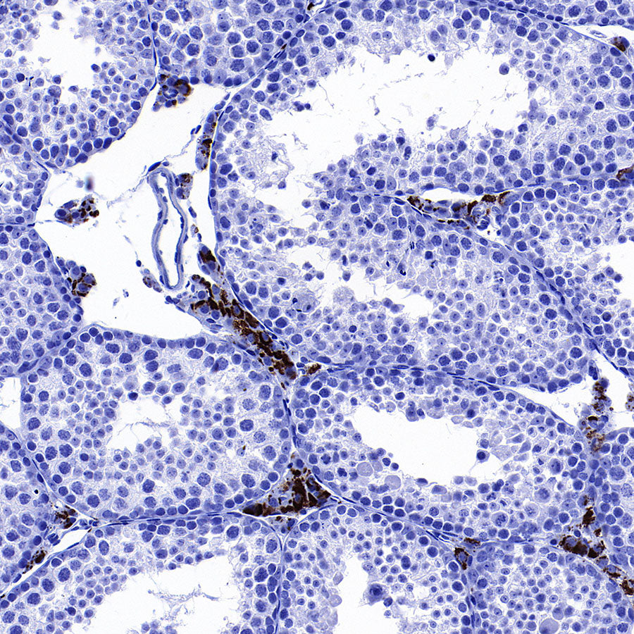 Perilipin-1 Recombinant Rabbit mAb (S-3093-31)